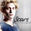 4x01: Resurrecion - Página 16 Jasper_scars