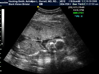 Will it be a boy or girl for ANMSMITH ????? NOAHSMITH10-20-08_11