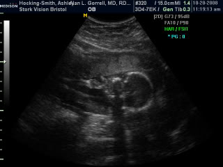 Will it be a boy or girl for ANMSMITH ????? NOAHSMITH10-20-08_4