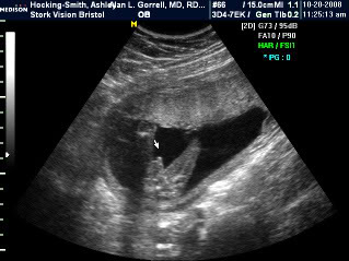 Will it be a boy or girl for ANMSMITH ????? - Page 2 NOAHSMITH10-20-08_9