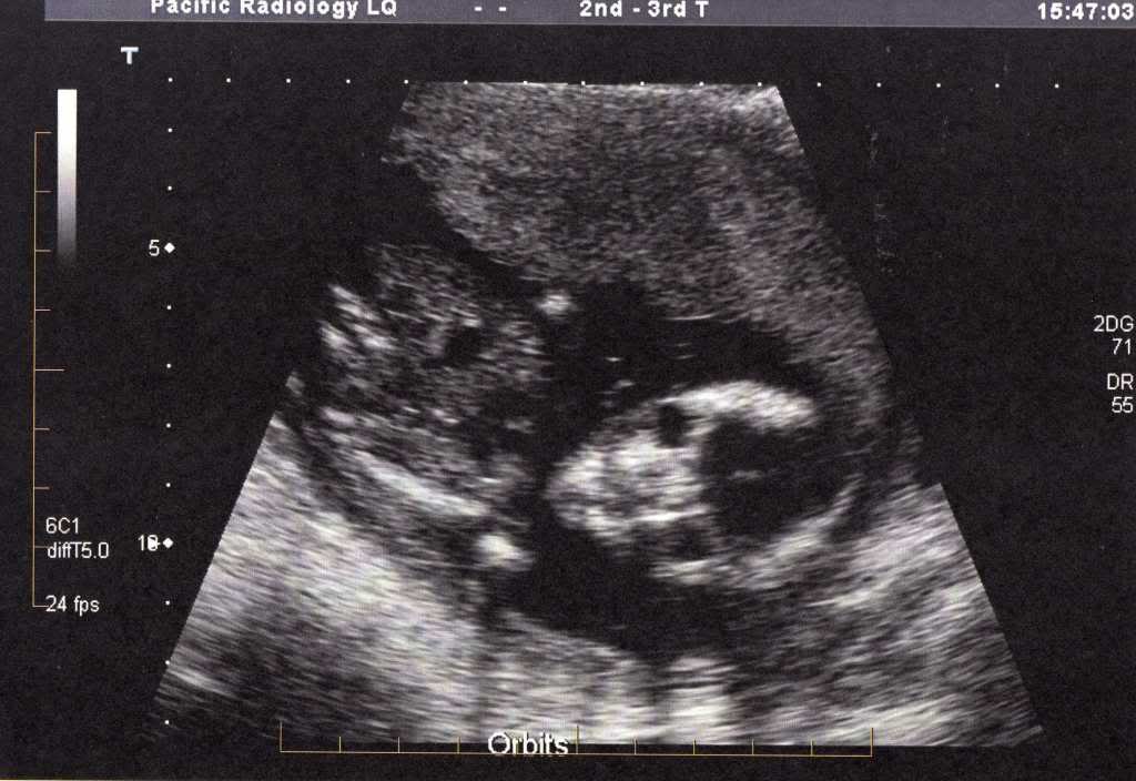 ZOMFG!!! I HAVE A SON OTW, LOOKIE~!!!!! Bubba