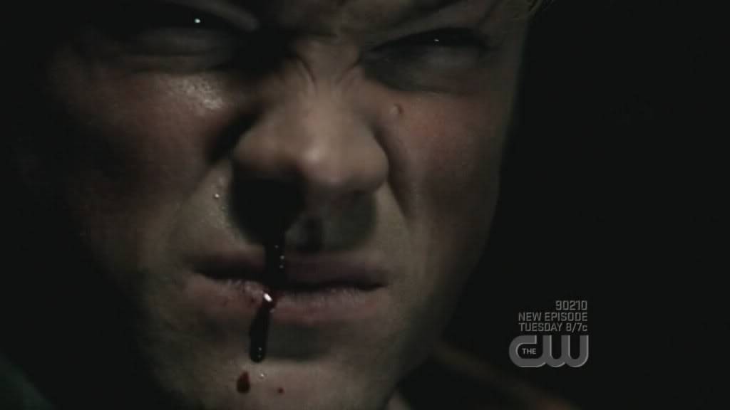 Episode 4x07 "It's The Great Pumpkin Sam Winchester" Snapshot20081031120011