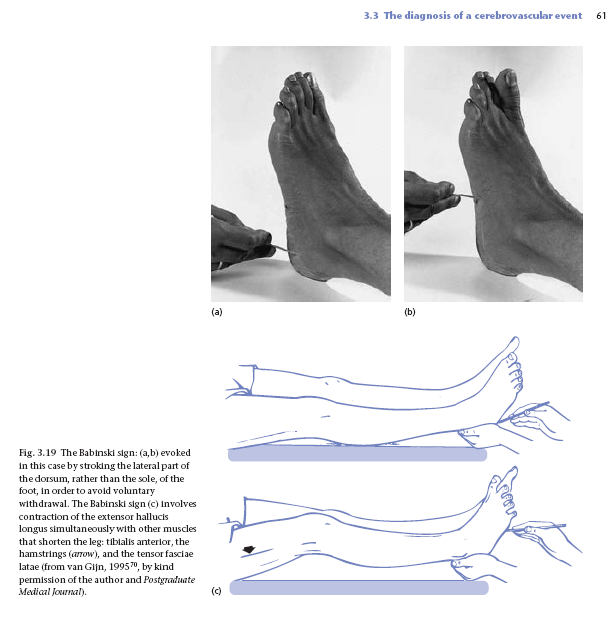 stroke practical management...... book in pdf Stroke002