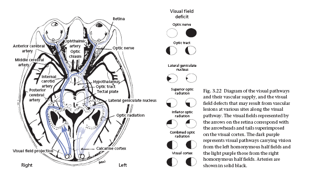 stroke practical management...... book in pdf Stroke003