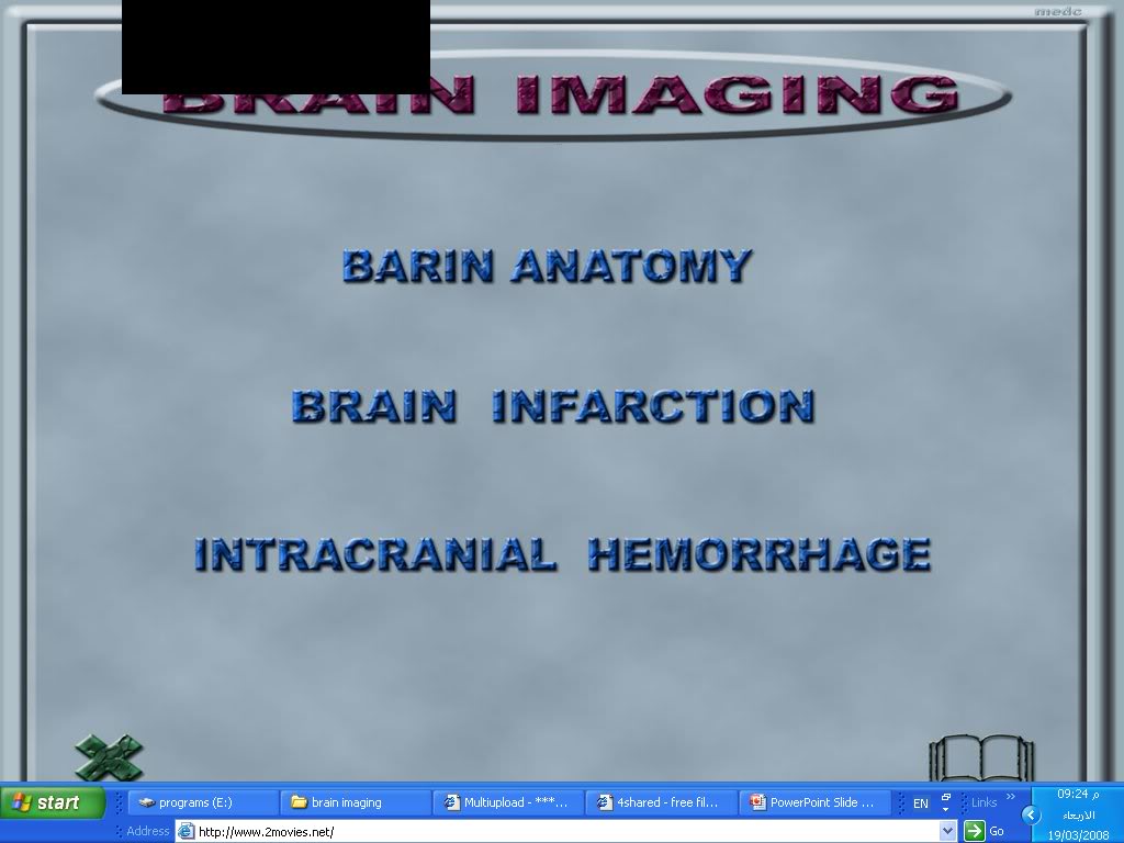 infarction,ischeamia or edema? images of brain make it clear Brainimaging003