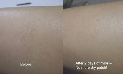 MIOR Miracle Bar Drypatch1