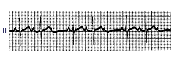 SPOT DIAGNOSIS -  5 1-1