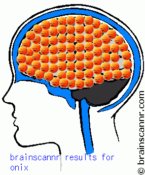 Jom kita main scan otak Brainscannr1