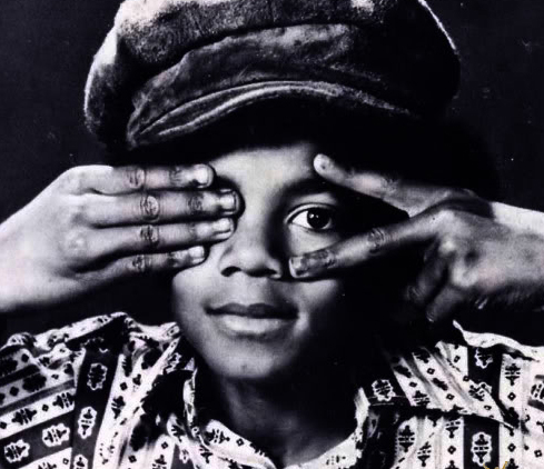 Michael Did NOT Change His Skin Color- He Had Vitiligo 1