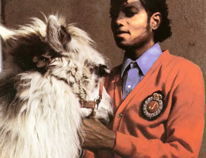 Michael Did NOT Change His Skin Color- He Had Vitiligo 15-2