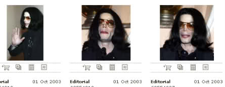 Michael - Michael Did NOT Change His Skin Color- He Had Vitiligo 15xr3ol