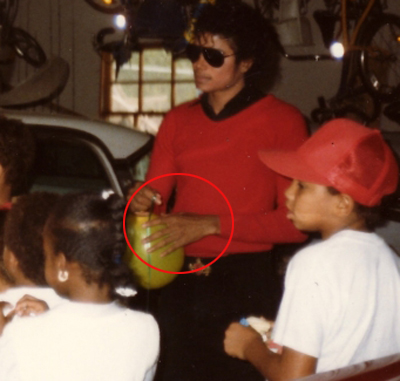 Michael Did NOT Change His Skin Color- He Had Vitiligo 19-3