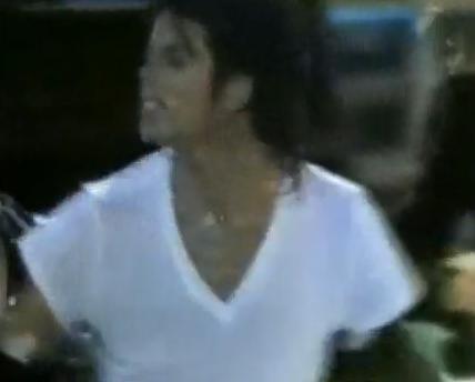 Michael Did NOT Change His Skin Color- He Had Vitiligo 32-1