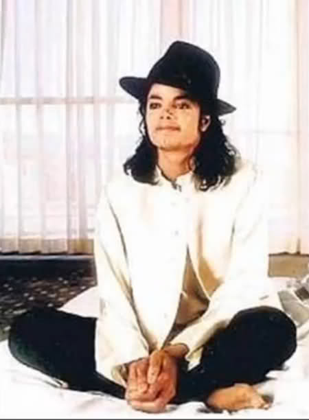 Michael Did NOT Change His Skin Color- He Had Vitiligo 43