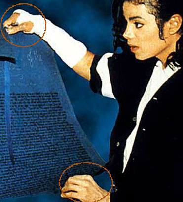 Michael - Michael Did NOT Change His Skin Color- He Had Vitiligo 48