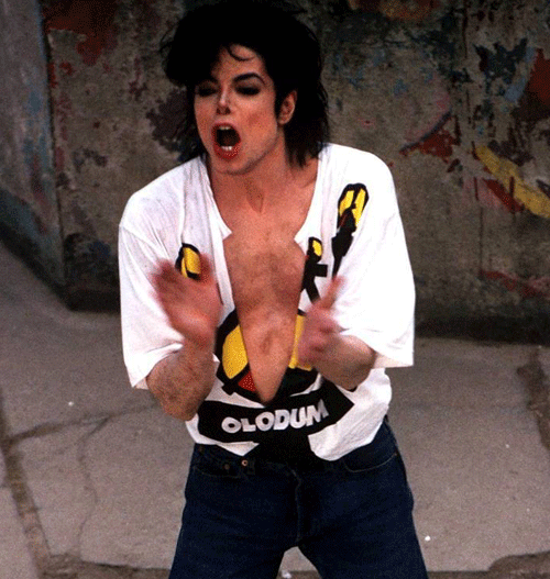 Michael Did NOT Change His Skin Color- He Had Vitiligo 49-1