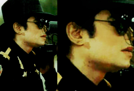 Michael Did NOT Change His Skin Color- He Had Vitiligo 51
