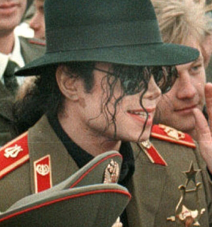 Michael Did NOT Change His Skin Color- He Had Vitiligo 52