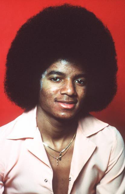 Michael Did NOT Change His Skin Color- He Had Vitiligo 6-1
