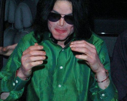 Michael - Michael Did NOT Change His Skin Color- He Had Vitiligo 60