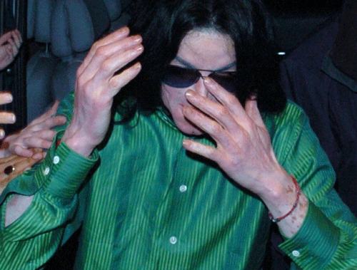 Michael - Michael Did NOT Change His Skin Color- He Had Vitiligo 61