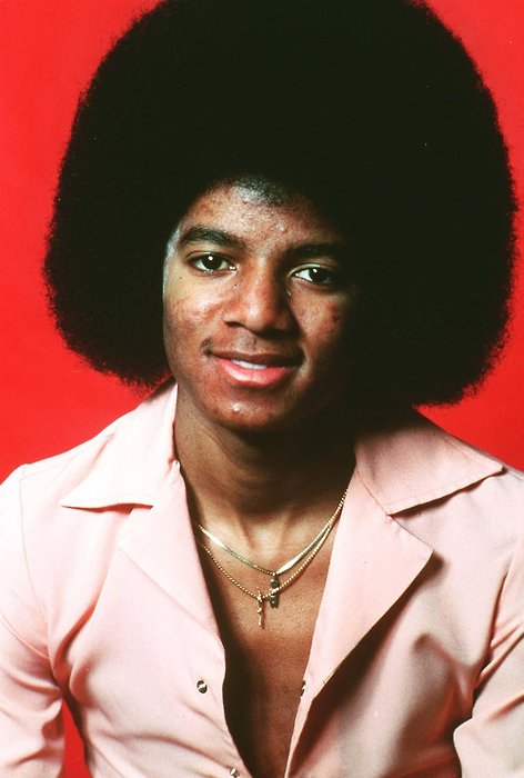 Michael Did NOT Change His Skin Color- He Had Vitiligo 7-1