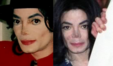 Michael Did NOT Change His Skin Color- He Had Vitiligo NQ5XT