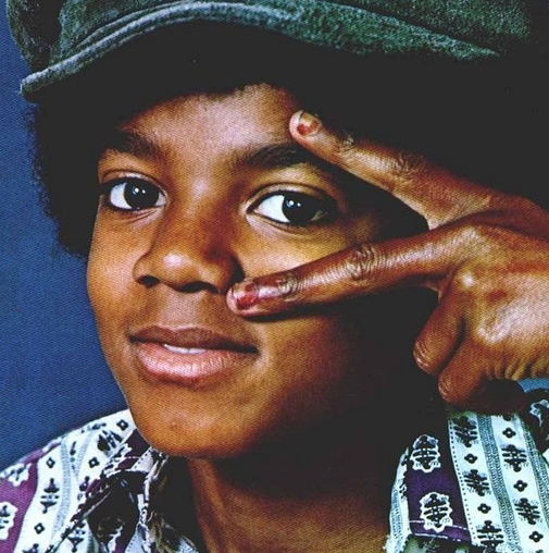 Michael - Michael Did NOT Change His Skin Color- He Had Vitiligo NWNwW