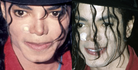 Michael - Michael Did NOT Change His Skin Color- He Had Vitiligo ZrWYF