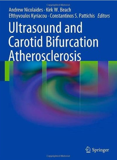 Ultrasound and Carotid Bifurcation Atherosclerosis 1ec6a91a64ab03240a37a3a0ad62ae78