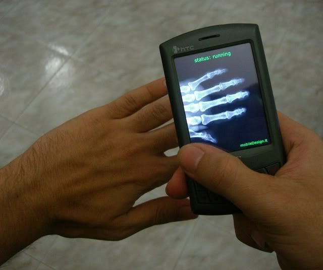 X-ray for mobile phones...S60 3rd edition Xrayonmobile