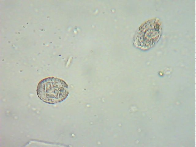microscope 2012_09_06_12_05_57_565