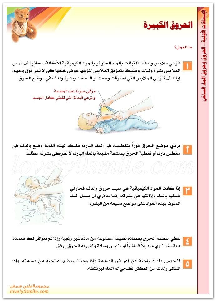 كيف تتعامل مع الحروق Esa-026