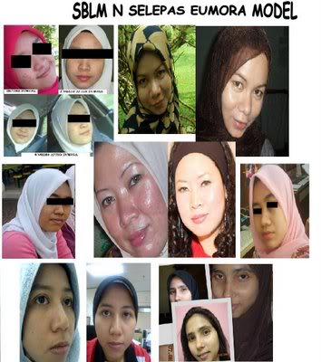 kyusoku bihaku~BETTER SUPERWHITE AS A pil pemutih kulit NO1~MOST EFFECTIVE PRODUCT IN THE WORLD (14 HARI DAH BERKESAN)-0133747473/0192197473 Modeleumora