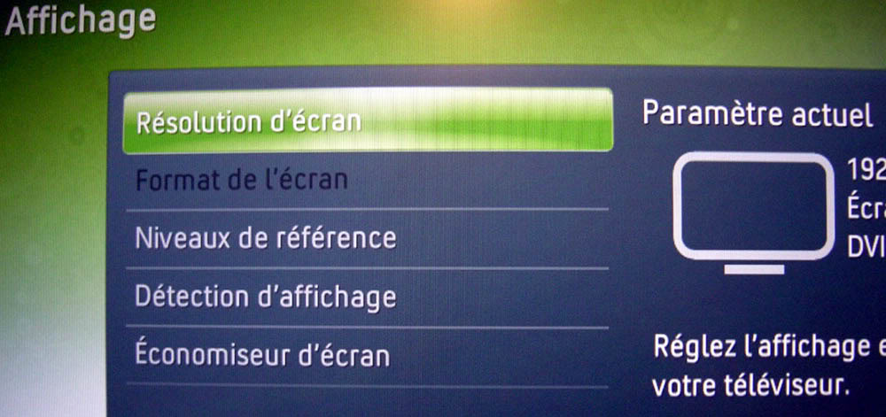 xbox 360 problème HDMI écran noir suite à "désactiver détection d'affichage" DSCN4300