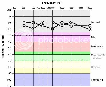 HELP MAGKAROON KAYA NG CONFLICT SA PAGPASA SA POEA NG MEDICAL KO? Normal_audiogram