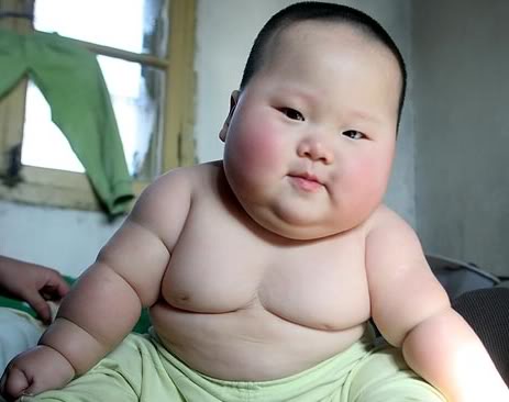 obesity Batna lecture nNO.2 Tekkaus-obese-baby