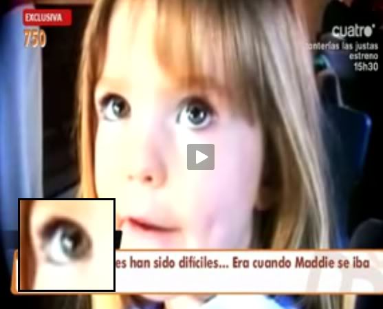 colobomaJust - The changing Coloboma of Madeleine 05