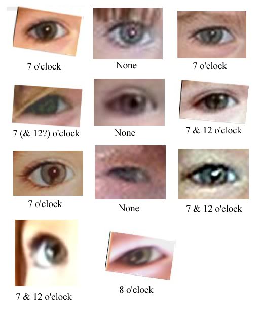 coloboma - The changing Coloboma of Madeleine ColobomaPosition