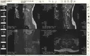 2010 : PUCES IMPLANTABLES, RFID, NANOTECHNOLOGIES, NEUROSCIENCES, N.B.I.C. ET CYBERNETIQUE - Page 4 MRIbrainscan