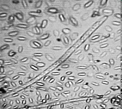 Insekten in en rond de voliëre, binnenhokken... deel 1 Filarianematodeninbloedpasseriform