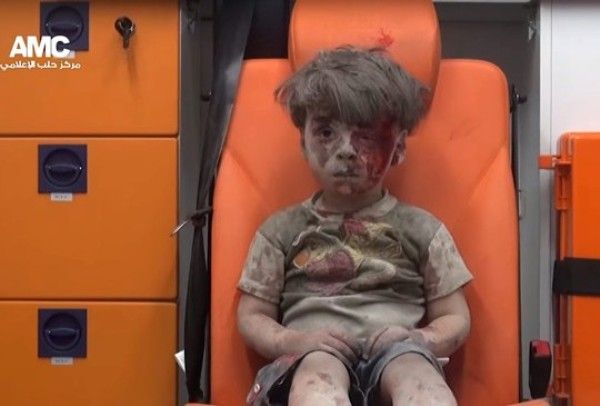 America and our ally Israel have always wanted to destroy the nation state of Syria Syrian-injured-boy_zpsmwhaykx5