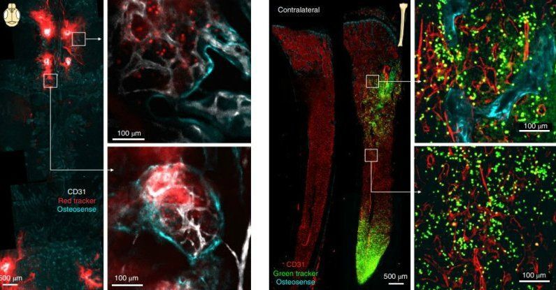 العثور على أنفاق سرية بين الجمجمة والدما Brain-channels-Fluorescence_web-1