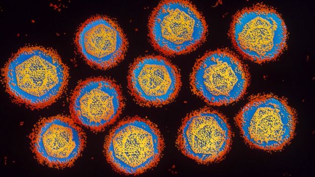 علماء يكتشفون نحو 1500 فيروس جديد _92641478_c0035137-dengue_virus_tem_-spl