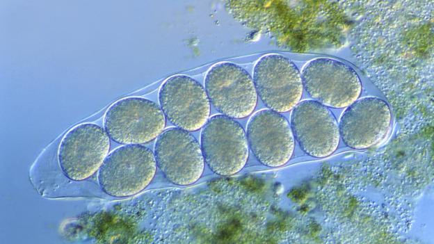 Tardigrade  extremophile with superpowers P02lv2bj