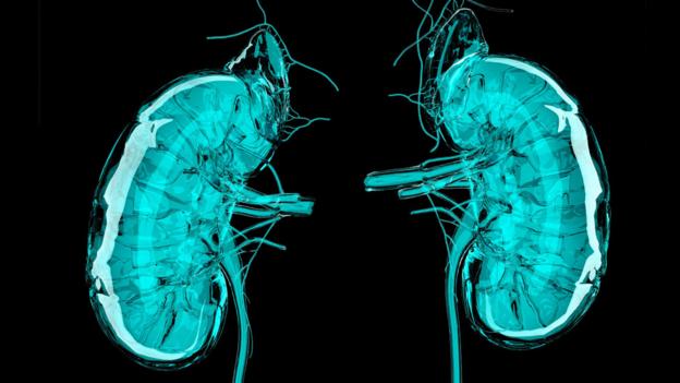 Printing a human kidney  P00v3tft