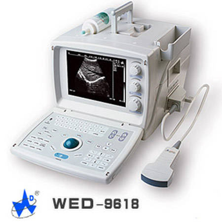 Le jeu du nombre en image... (QUE DES CHIFFRES) - Page 39 Portable_Electronic_Convex_Ultrasound_Scanner_WED-9618_