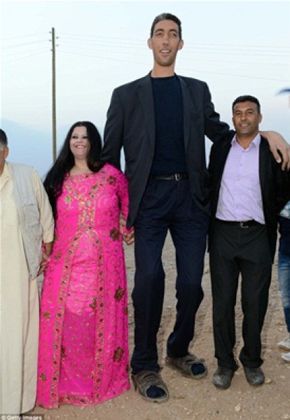 شاهد بالصور.. حفل زفاف أطول رجل في العالم والغريب كم يبلغ طول زوجته 3910016658