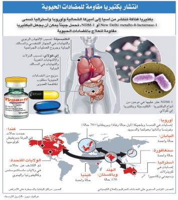 «بكتيريا آسيوية» مقاومة لأقوى المضادات الحيوية.. تنتشر عبر العالم 2571263214