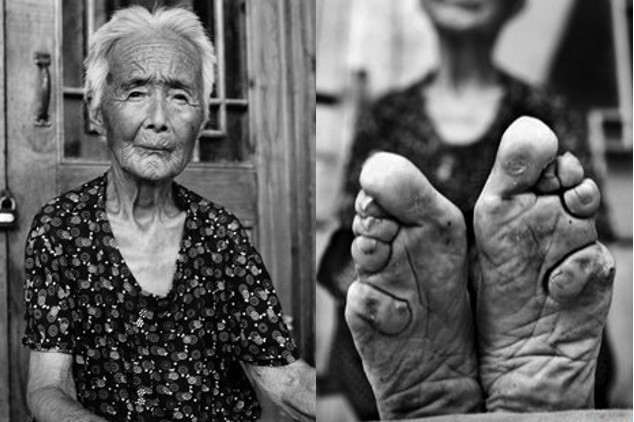 Potret Wanita-wanita China dengan Jari Kaki Menyatu Akibat Foot-Binding Foto5besar
